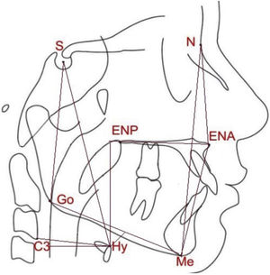 Linear measures analyzed in the present study: N-Me, total anterior facial height; N-ENA, superior anterior facial height; ENA-Me, inferior anterior facial height; S-Go, total posterior facial height; HYS, distance between the hyoid and the base of the skull; HYMP, distance between the hyoid and the mandibular plane (Go-Me); horiz.d-H, measure between the Hy (hyoid) point and the posterior pharyngeal wall; vert.d-H, distance from the Hy point (hyoid) to the palatal plane (ENA-ENP); C3-H, measure from the Hy point (hyoid) to C3 point (cervical column).