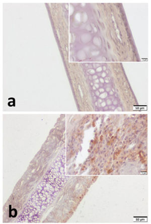 VPAC2 immunohistochemistry for (a) Control group and (b) Pregnant group. VPAC2 was found to be stained in all layers of septal mucoperichondrium. Subepithelial hypercellularity was remarkable in the pregnant group (b). Overall staining intensity was more explicit in specimens of pregnant group. (Scale Bars =50μm and 10μm).