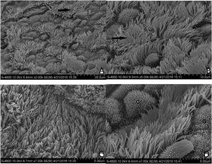(A and B) Morphological structure of the ET mucosa in group A under SEM. There is a significant and discontinuous loss of cilia in the ET mucosa. The number of ciliated cells in the opening area near the tympanic cavity is significantly reduced and the density decreased. In (A), the black arrow is directed toward the cilia missing area. In (B), the black arrow points to cilia obviously lodged, and a gathering area on a massive scale. (C and D) Morphological structure of the ET mucosa in group B under SEM. In (C), the full-length surface of the ET mucosa is covered with cilia, without ciliary loss or obvious lodging. In (D), the ciliated cells are scattered in the middle of the mucosa; The “G” indicates goblet cells.