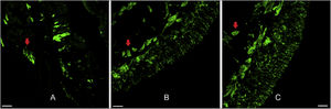 Human olfactory epithelium. Immunofluorescence of human olfactory epithelium suitable for morphological analysis in biopsy from the superior nasal septum with neuronal marking. In figure A we see anti-olfactory marker protein antibody (OMP 1:100, for mature olfactory neurons) marking. Figures B and C used the anti-beta tubulin III label (β 3 1:100, total, for mature and immature neurons). The red arrows indicate the presence of nerve bundles. Scale bar with 25 µm.