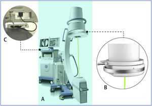 Components of the SAVN system: (A) the navigator is built on a C-arm machine; (B) laser driving device; (C) data processing module.