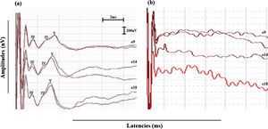 (a) Typical intraoperative eABR recordings classified as positive eABRs. Wave V could be recorded in two replications of the same stimulus condition in the three tested electrodes (electrodes 9, 14 and 18). (b) Negative eABRs recorded in the subject #21. Wave V could not be identified in both stimuli replications in one or more tested electrodes.