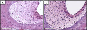 Photomicrographs of the spiral ligament of CG (A) and MG (2‒14 months) animals, with higher cell density in B. H&E staining.
