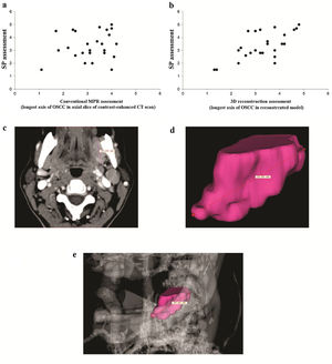 Dispersion graphics with moderate correlation between Multiplanar Reconstruction (MPR) images and Surgical Pathology Specimens (SPS) (A). Strong correlation between three-dimensional segmentation (3DS) model and SPS (B). Axial slice of MPR image (C) and 3DS image (D) of tumor measurements. 3DS image of tumor with skeleton (E).