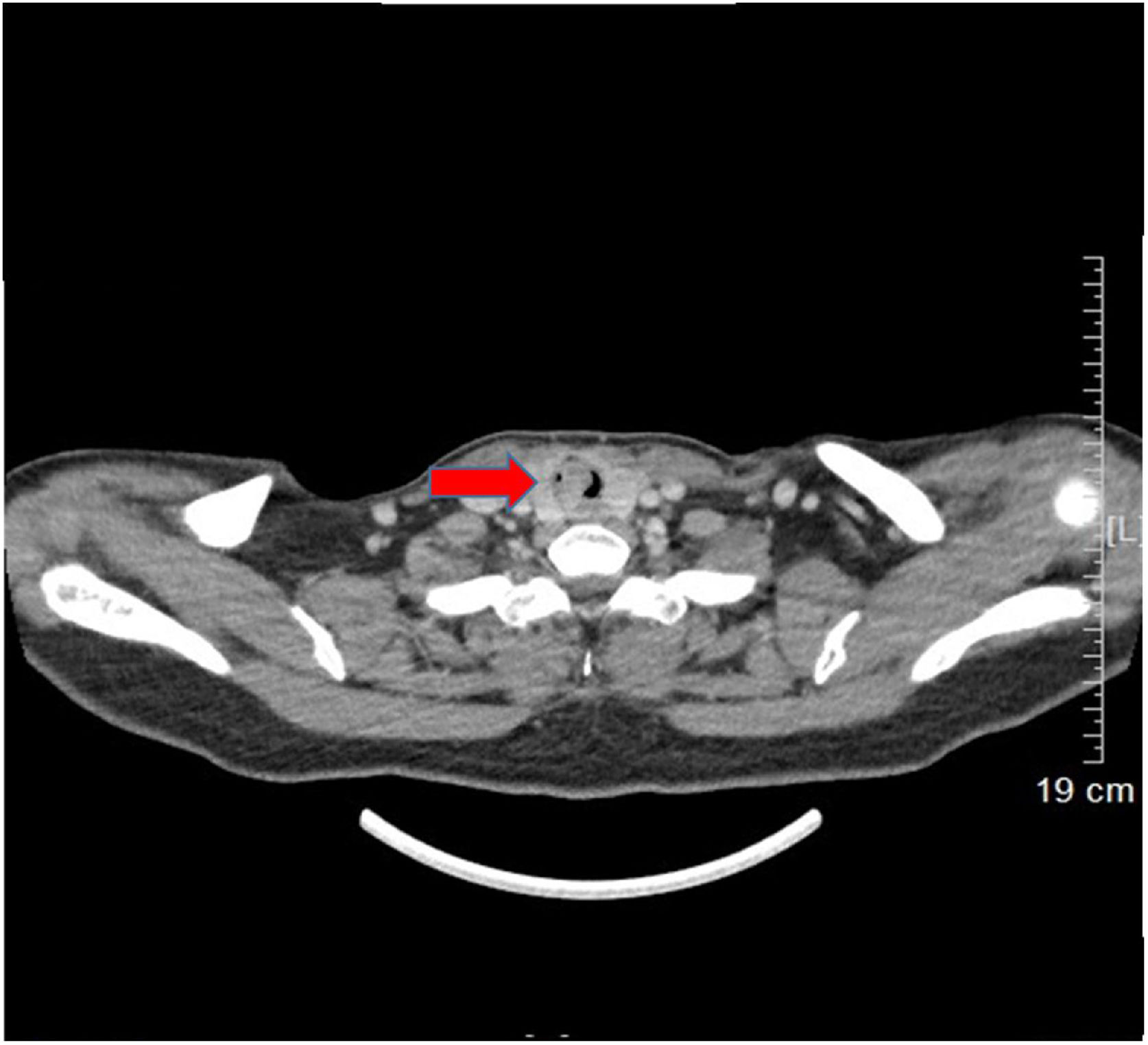 fig0005