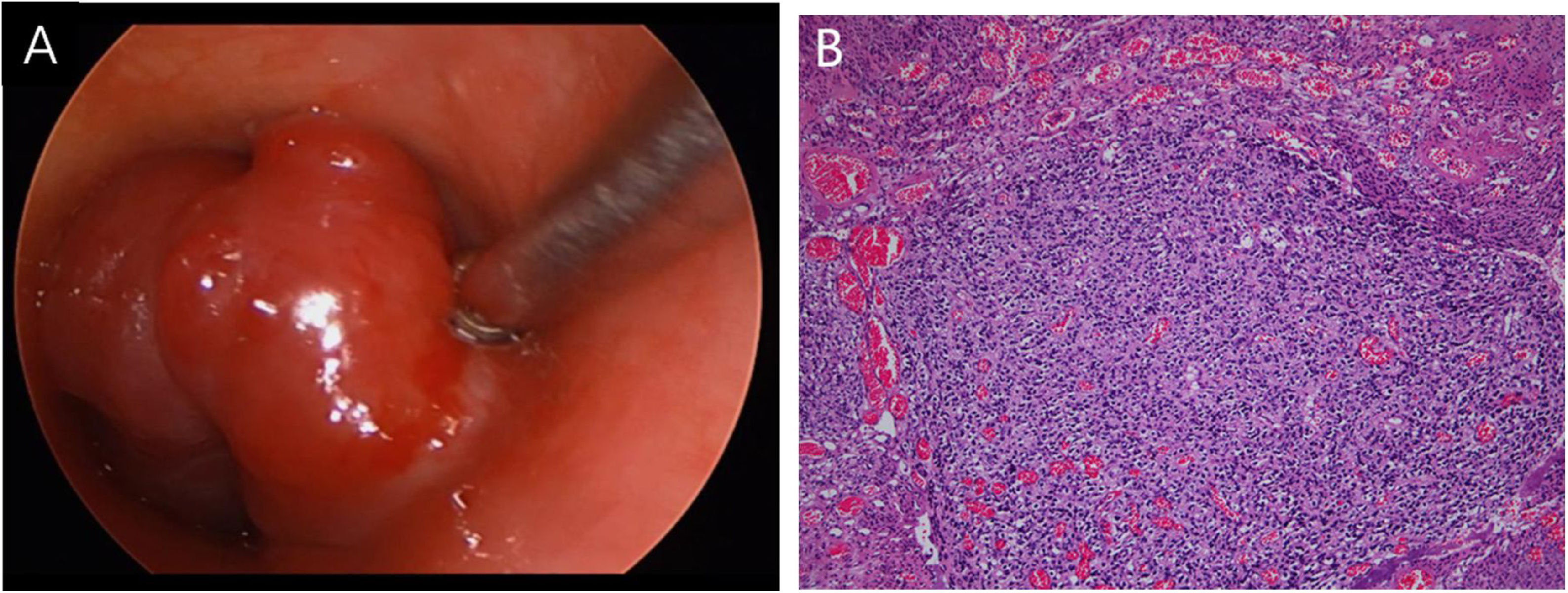 fig0010