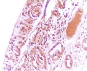 Very severe (+4) immunostaining of olfactory epithelium with the olfactory marker protein (OMP, ×400).