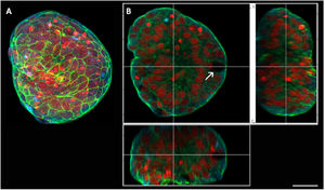 Scanning confocal microscopy of spheroids of nasal polyp-derived cells with 7 days of culture. (A) 3D reconstruction of a spheroid with 7 days of culture. (B) Orthogonal sections of the previous image, where it is possible to observe the interaction of cells inside the spheroid. Goblet cell (arrow). In red it is possible to visualize the nuclei of the cells (propidium iodide), in green the actin filaments (FITC-phalloidin) and the microtubules-alpha and beta tubulin in blue (Cy5). Barr 30 µm.