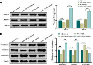 Effect of miR-150-5p on the expression of Matrix Metalloproteinase (MMP) and Epithelial-Mesenchymal Transition (EMT)-related proteins in Hep-2 cells. (A‒B) Western blot to assess the expression of Matrix Metalloproteinase (MMP)-related proteins MMP-2 and MMP-9 (A) and Epithelial-Mesenchymal Transition (EMT)-related proteins (N-cadherin, Vimentin and E- cadherin) (B) in Hep-2 cells; **p < 0.01; ***p < 0.001.