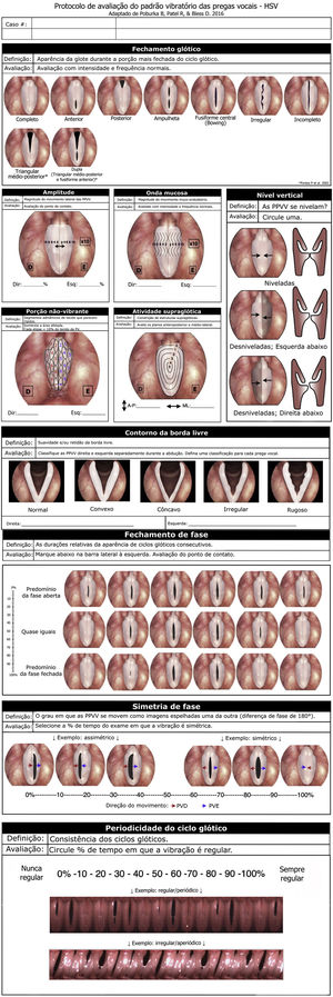 Assessment protocol of vocal folds vibration pattern for high-speed videolaryngoscopy, adapted from the VALI protocol4 an translated into Brazilian Portuguese.