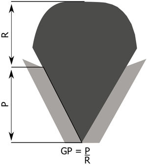 Schematic representation of glottic proportion. P, Phonatory region; R, Respiratory region; GP, Glottic proportion. Figure adapted from Pontes et al.13