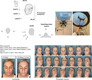 Patient and examiner positioning in the session. facial markings and capture levels of the photographic sequence phases. Note: The photographic sequence only illustrates the capture levels, not the number of captures per phase.