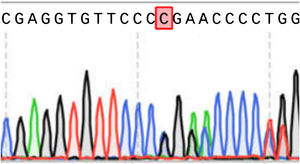 Results of COL1A1 exon sequencing (reference sequence: NM000088).