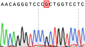 Results of COL1A2 exon sequencing (reference sequence: NM000089).