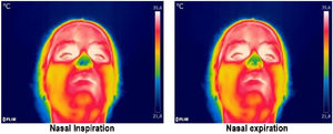 Thermograms selected with the experimental apparatus, during inspiration (right) and expiration through nose (left). In the scale used, the highest temperatures (close to 35.6°) are represented in red, whereas temperatures close to 21.8° are represented in blue.