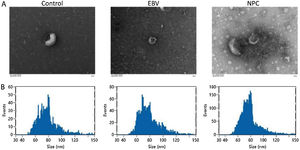 The extracted exosomes were identified. (A) The morphology of exosomes was imaged using the transmission electron microscopy. (B) The particle size of exosomes was detected by the Nanoparticle Tracking Analysis (NTA).
