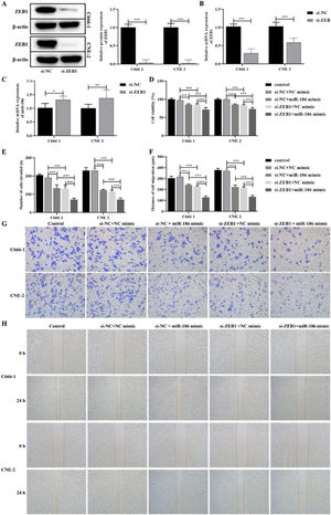 Effects of miR-186/ZEB1 regulatory network on proliferation and metastasis of NPC cells. (A) The protein expression of ZEB1 in NPC cells transfected with si-ZEB1 was detected by WB. Full-length blots/gels are presented in Supplementary Fig. 5. (B) The gene expression of ZEB1 in NPC cells transfected with si-ZEB1 was detected by RT-PCR. (C) The gene expression of miR-186 in NPC cells transfected with si-ZEB1 was detected by RT-PCR. (D) Cell viability was detected by CCK8. (E) The number of cells invaded. (F) Cell migration distance. (G) Representative images of cell invasion measured by transwell. (H) Representative images of cell migration detected by scratch assay. *p<0.05, **p<0.01, ***p<0.001.