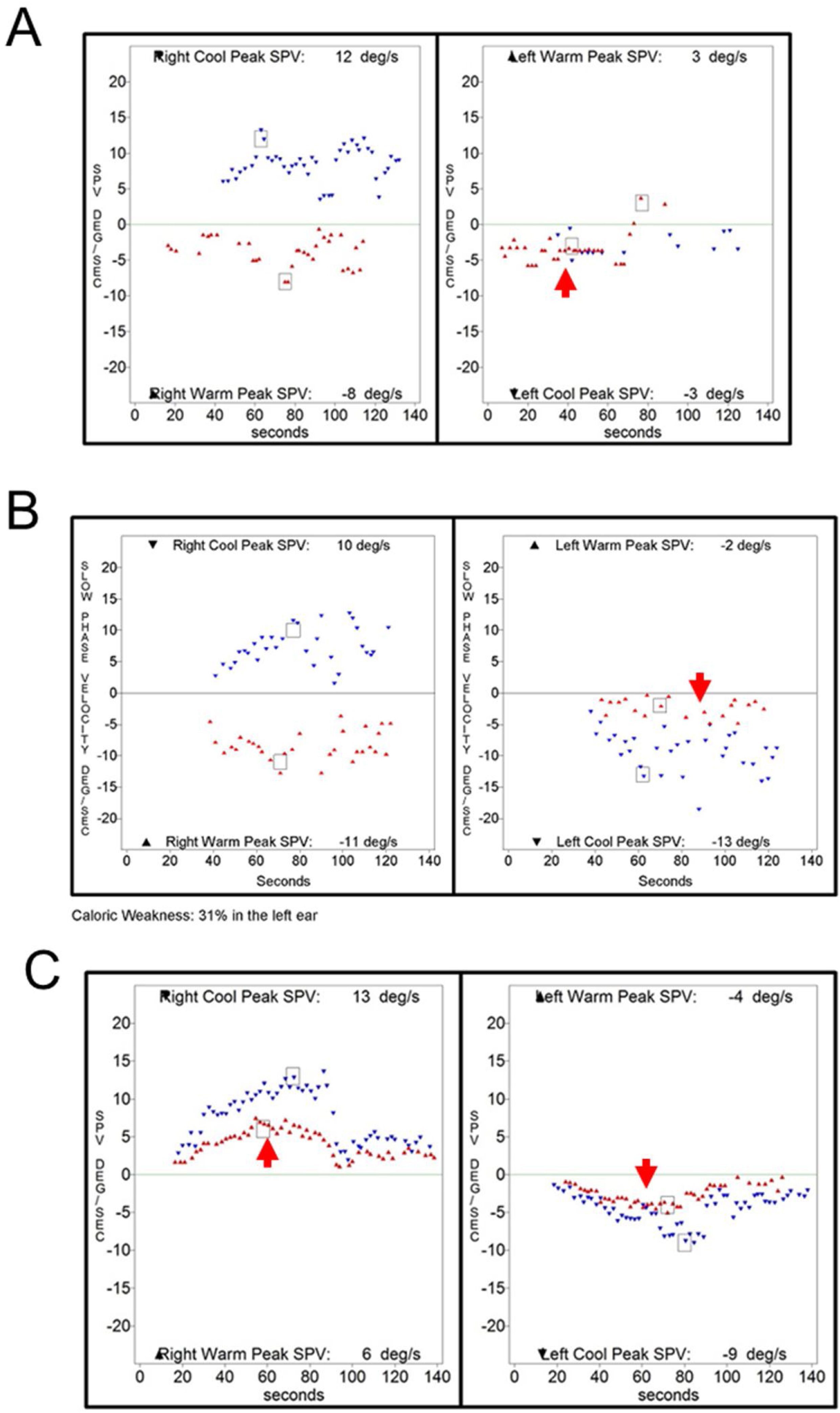 Clinical diagnoses of patients showing caloric inversion | Brazilian ...