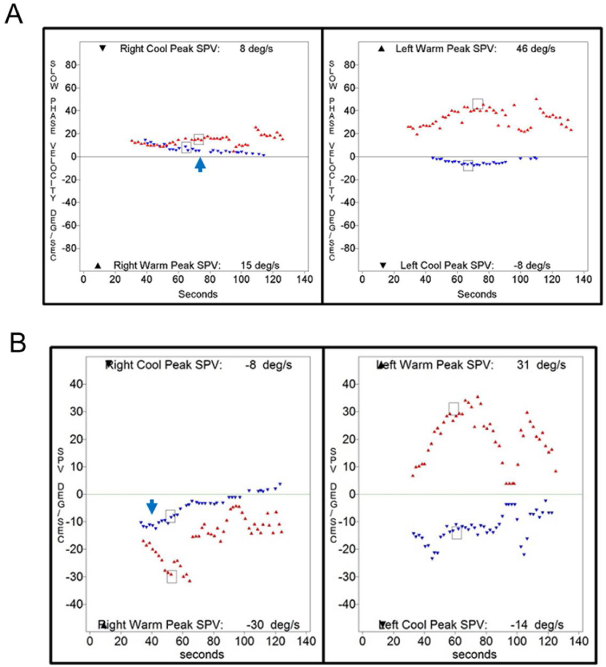 Clinical diagnoses of patients showing caloric inversion | Brazilian ...