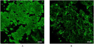 Confocal laser scanning micrographs of the turbinate (A) and nasal polyp (B) stained for Frizzled3. The honeycomb pattern of fluorescence indicates that Frizzled3 is localized along the cell junction on the apical surface. Scale bar = 20 μm.