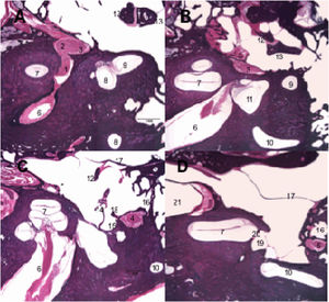 Histological sections of temporal bone at 20× magnification, right ear, stained with hematoxylin & Eosin. 1: Facial nerve, labyrinthine segment; 2: Geniculate ganglion; 3: Facial nerve, tympanic segment; 4: Mastoid segment of the facial nerve; 5: Facial nerve, mastoid segment; 6: Internal auditory canal; 7: Cochlea; 8: Superior semicircular canal; 9: Lateral semicircular canal; 10: Posterior semicircular canal; 11: Utricle; 12: Malleus; 13: Incus; 14: Stapes; 15: Tympanic sinus; 16: Facial recess; 17: Tympanic membrane; 18: Pyramidal eminence; 19: Oval window niche; 20: Oval window; 21: Carotid artery.