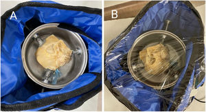 Right temporal bone wrapped in thermal blanket. (A) Without plastic PVC film. (B) With PVC plastic film.