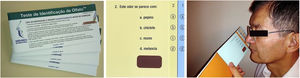 The four booklets of the University of Pennsylvania Smell Identification Test (UPSIT), one of the test pages, and a patient attempting to identify one of the odors after scraping the strip with the booklet close but without touching their nose.