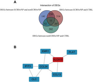 Construction of the PPI network for DEGs. (A) A total of 11 intersection genes in DEGs between the three groups. (B) PPI network constructed by 7 core DEGs.