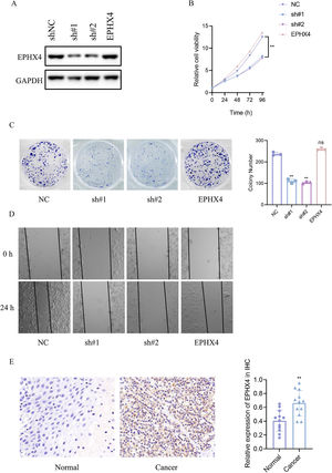 EPHX4 promoted the proliferation, migration of laryngeal cancer cell line. (A) Immunoblotting of normal control (NC) versus EPHX4 knowdown with sh#1, sh#2, and vector versus EPHX4-overexpressing (EPHX4) efficiencies in HN6 cell line. (B) CCK-8 assay was performed in NC and EPHX4 knockdown and overexpression in HN6 cell line. (C) Clonogenic assays of NC and EPHX4 knockdown and overexpression HN6 cell line were recorded (left) and quantitatively analyzed (right). (D) Wound healing assays of EPHX4 knockdown and overexpression in HN6 cell line were recorded. (E) Left: Representative IHC images of EPHX4 protein levels in LSCC tumors and in paired normal tissues.Scale bar:100 uM. Right: EPHX4 protein levels were significantly lower in ESCC tumors than in paired normal tissues (n = 12).