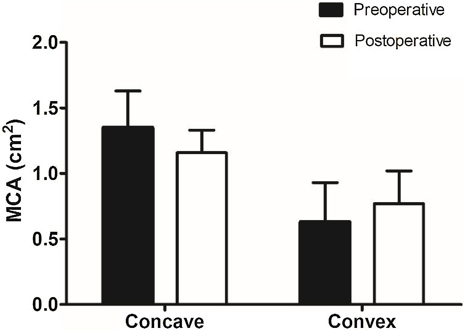 Functional and esthetic outcomes of functional rhinoplasty for internal ...