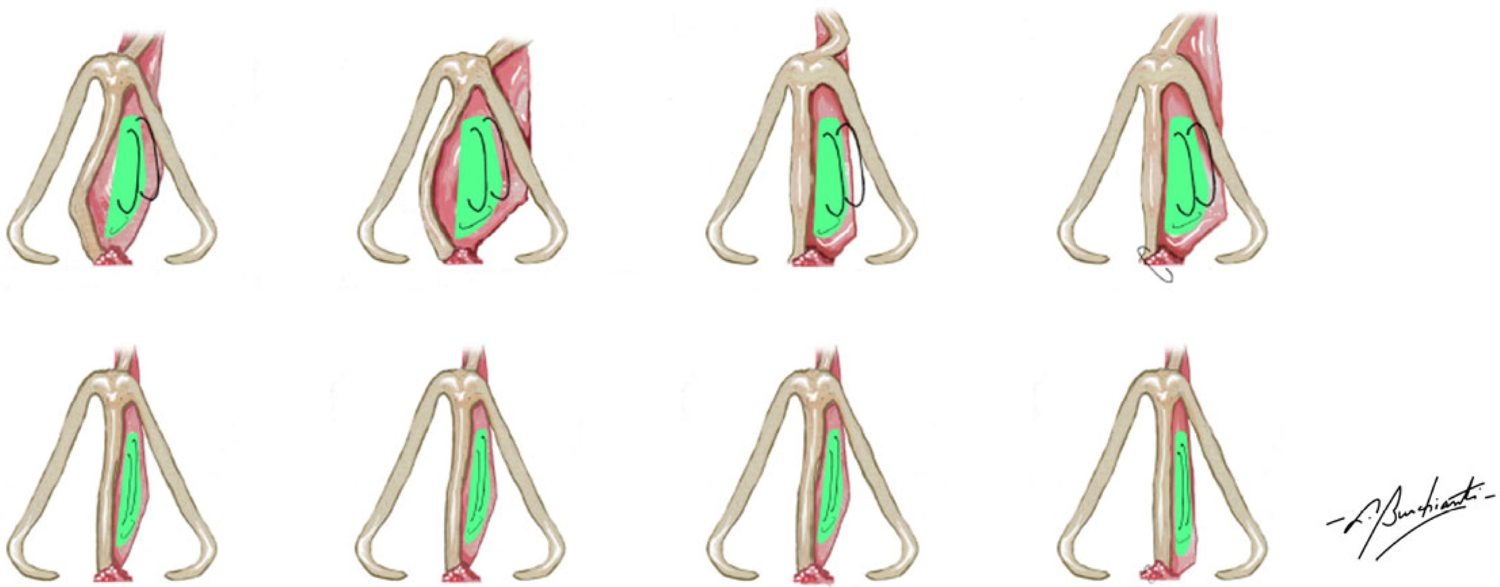 fig0015