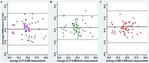 Bland-Altman plot for the agreement between manual CT, MRI, and MRI-Auto estimated cochlear duct length. (A) Showing the agreement between manual CT and MRI, (B) Showing the agreement between manual CT and MRI-Auto, and (C) Showing the agreement between manual MRI and MRI-Auto.