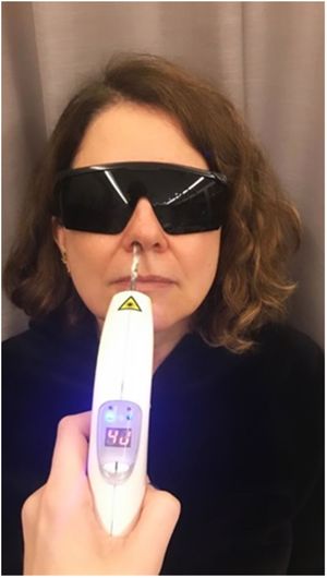 A subject is shown performing photobiomodulation, positioned seated with the head slightly tilted back. The applicator tip was inserted into the nostrils at around 1 cm for 40 seconds (video available online).