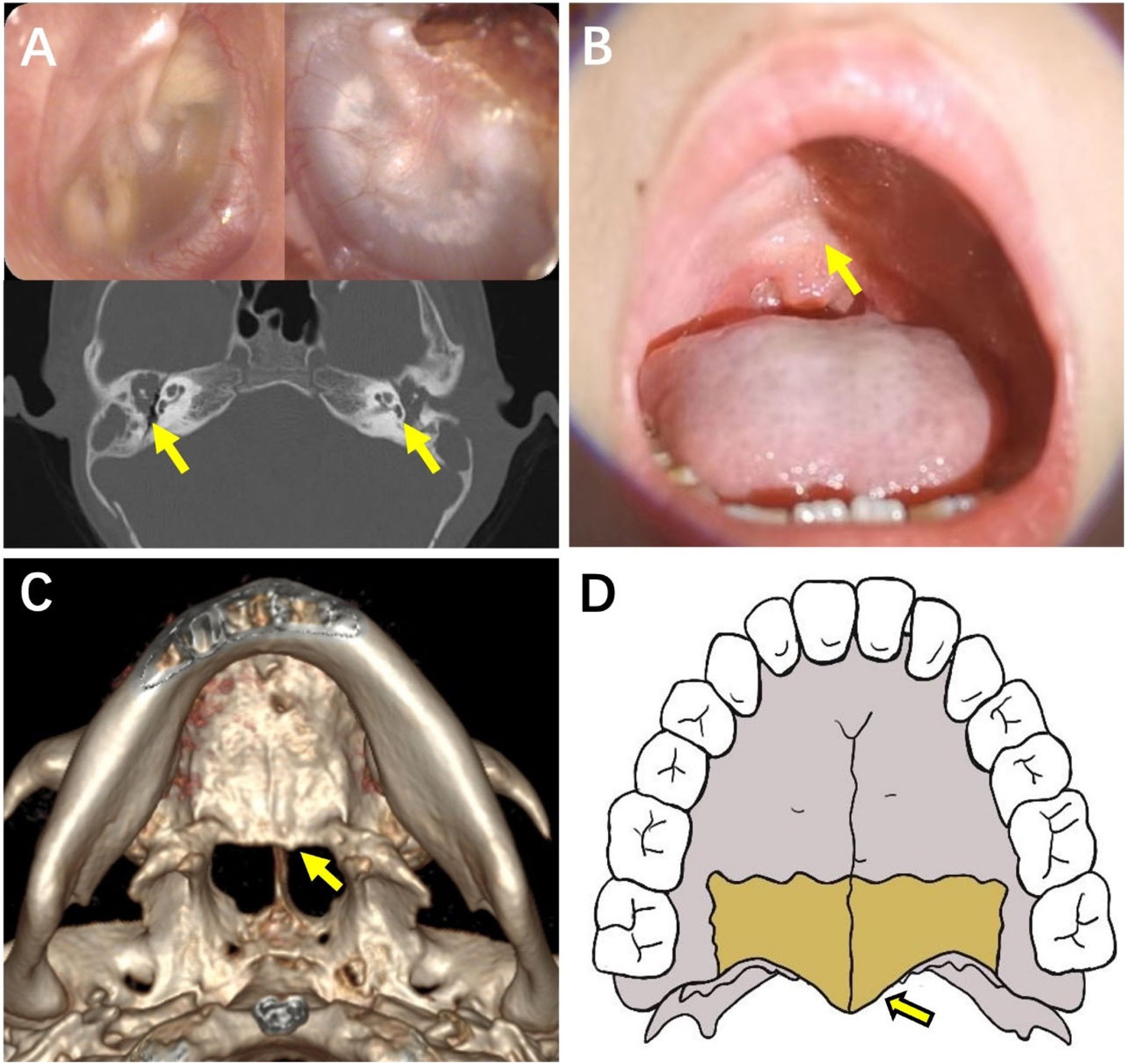 fig0010
