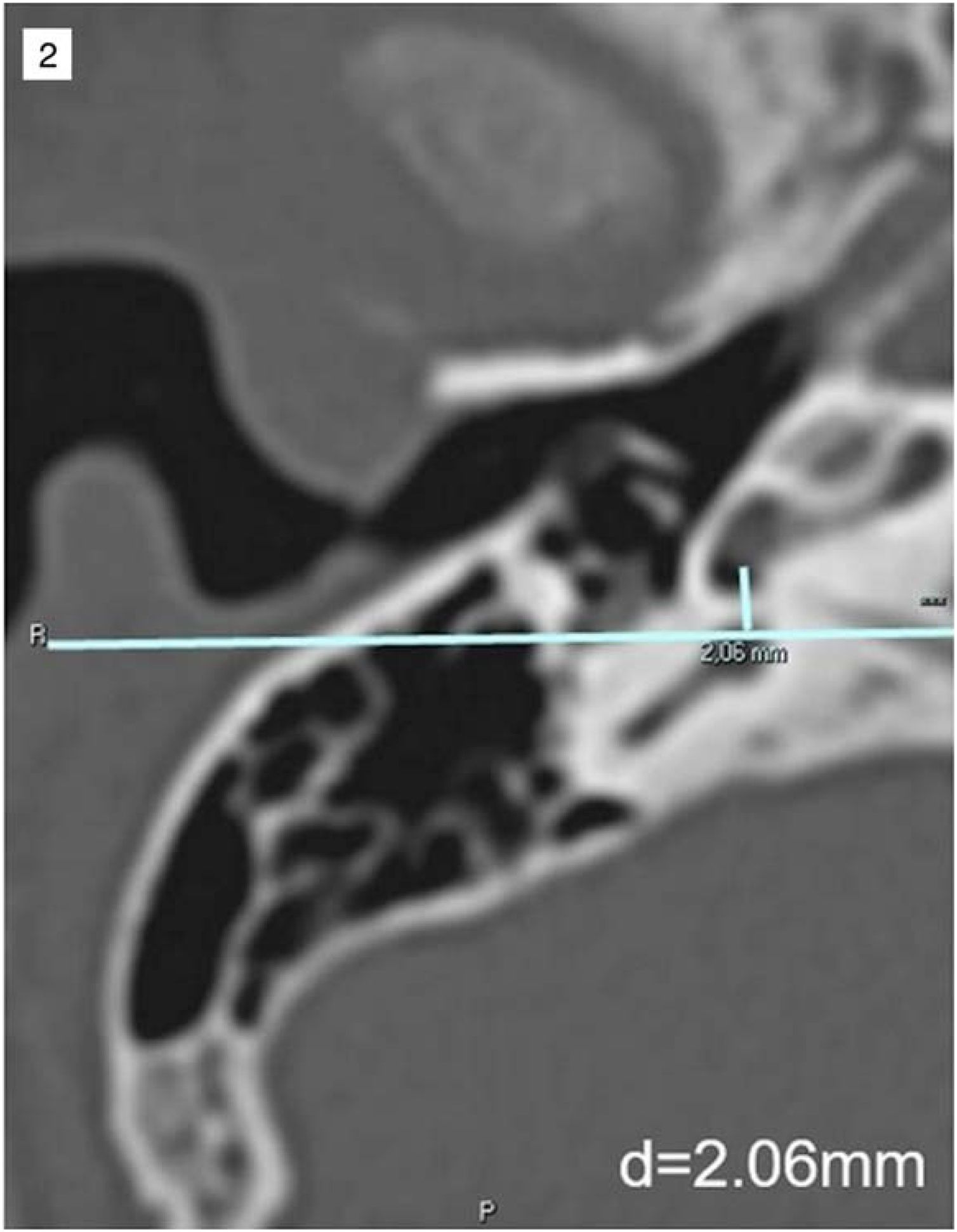 fig0010