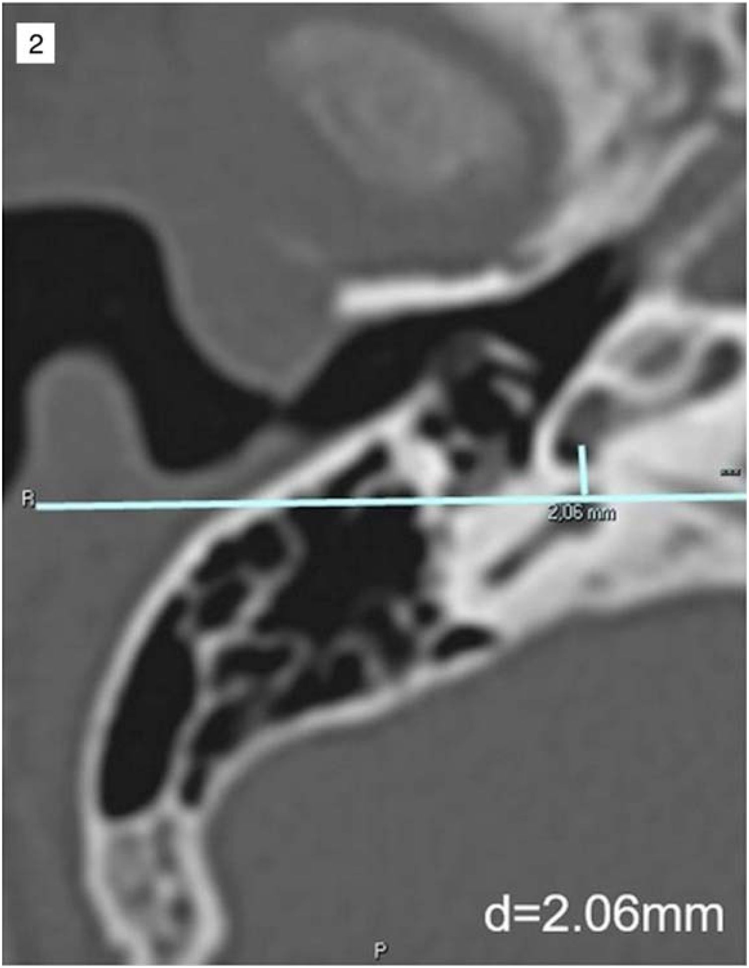 fig0015