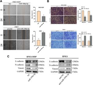 Effect of miR-199a-5p on migration and invasion. (A) Effects of different levels of miR-199a-5p on the migration of nasopharyngeal carcinoma cells. (B) Transwell assay was used to analyze the effect of miR-199a-5p on the migration and invasion of NPC cells. (C) Effect of miR-199a-5p on EMT-related proteins. Data are means ± SD, * p < 0.05.
