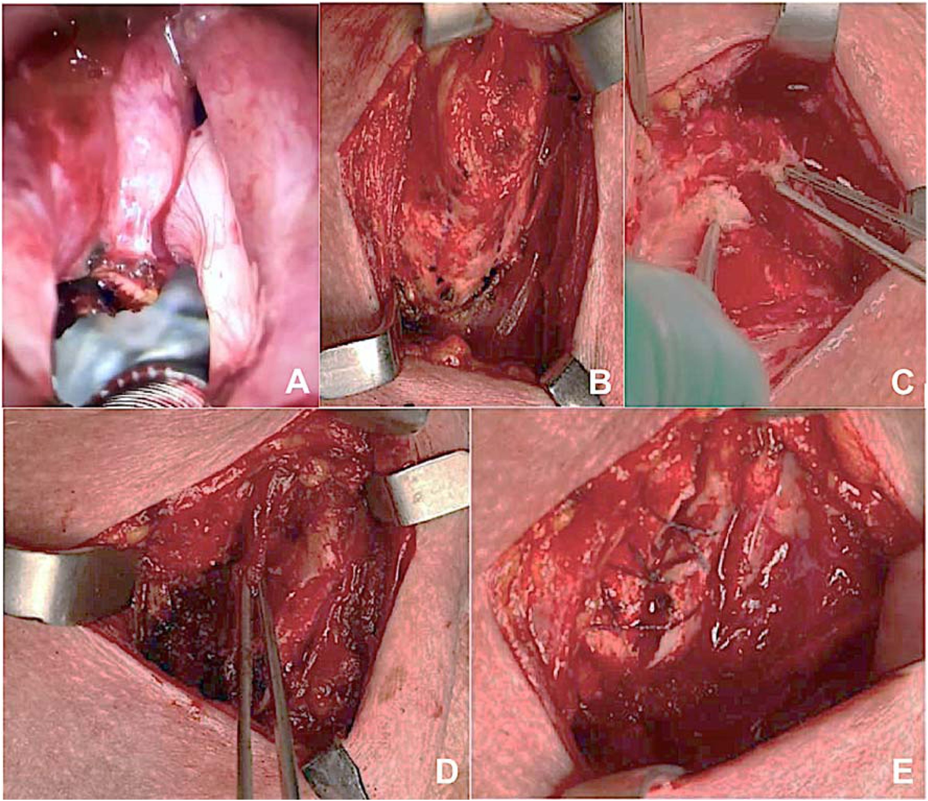fig0010