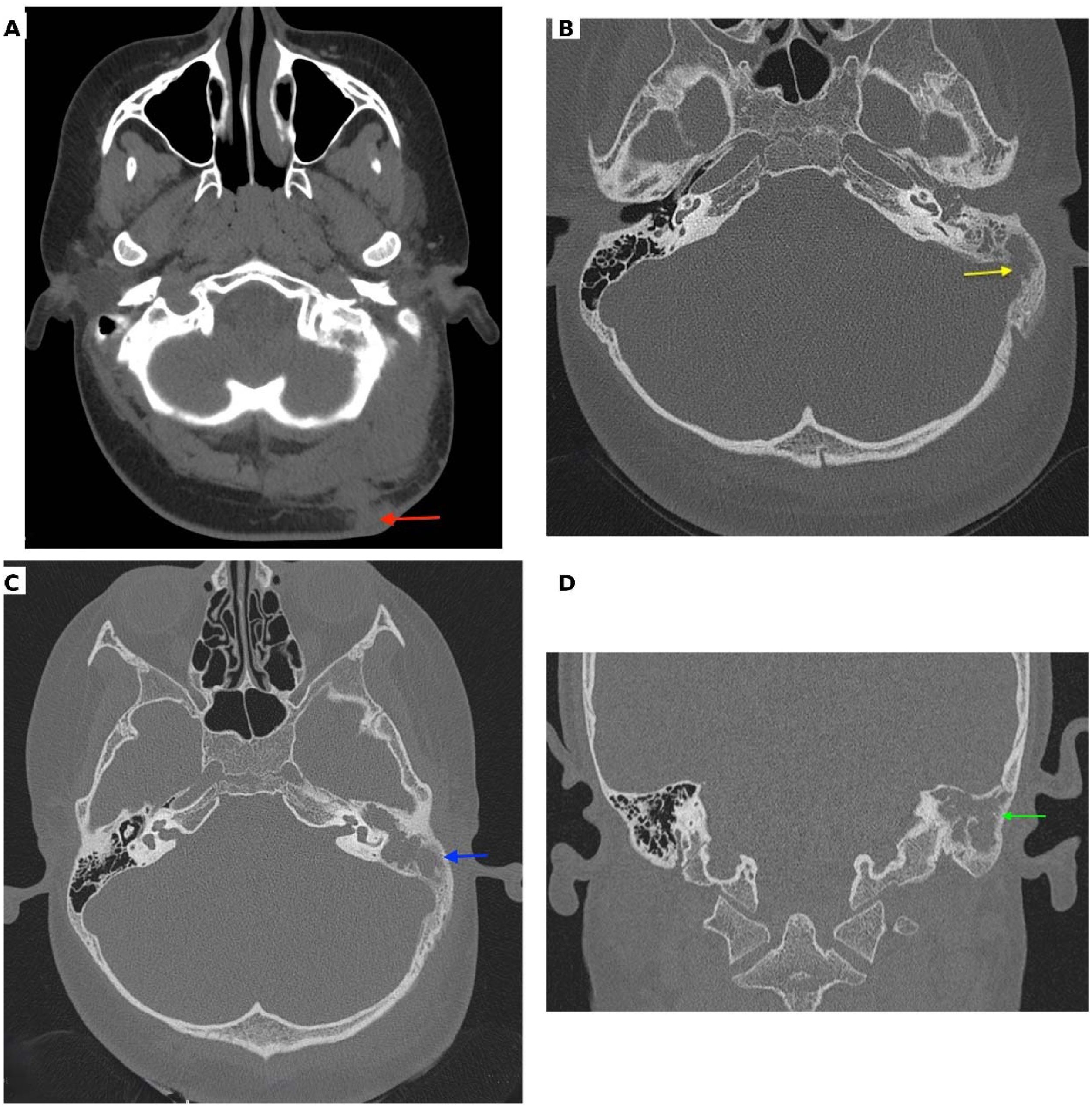 fig0010