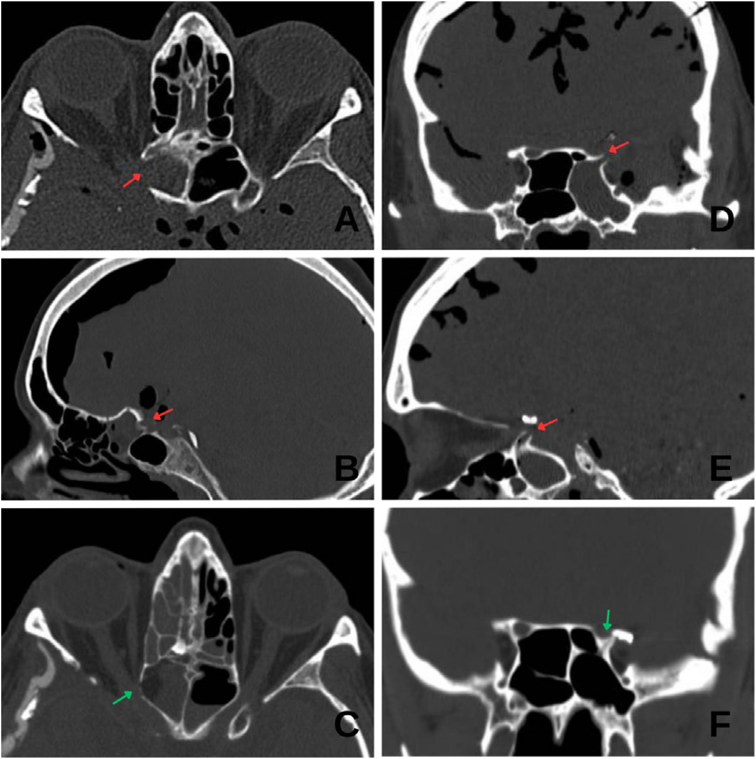 fig0005