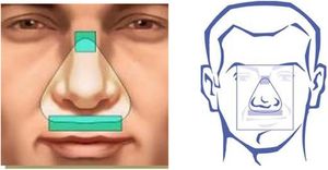 Triangular points for nasal mask fitting.