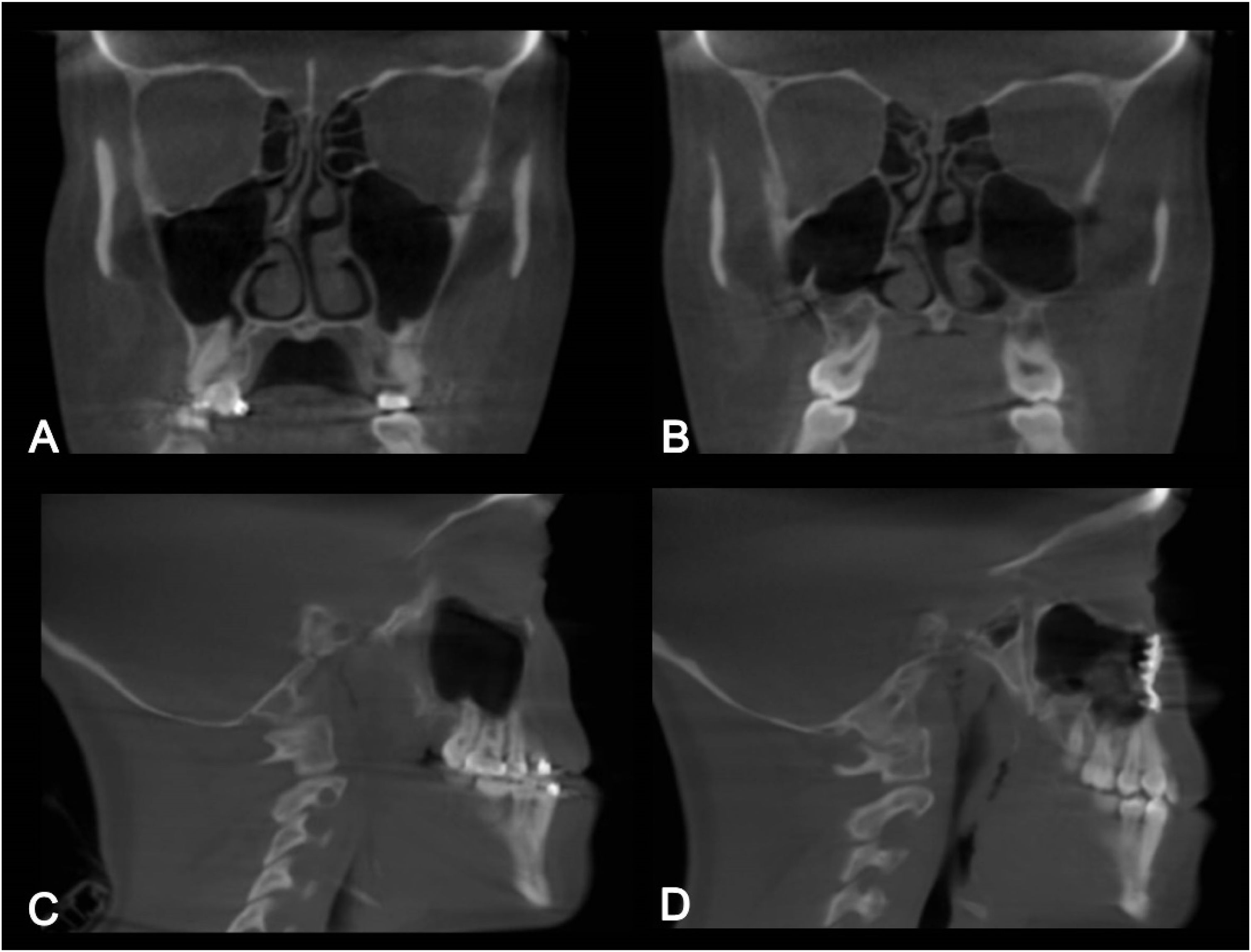 fig0005