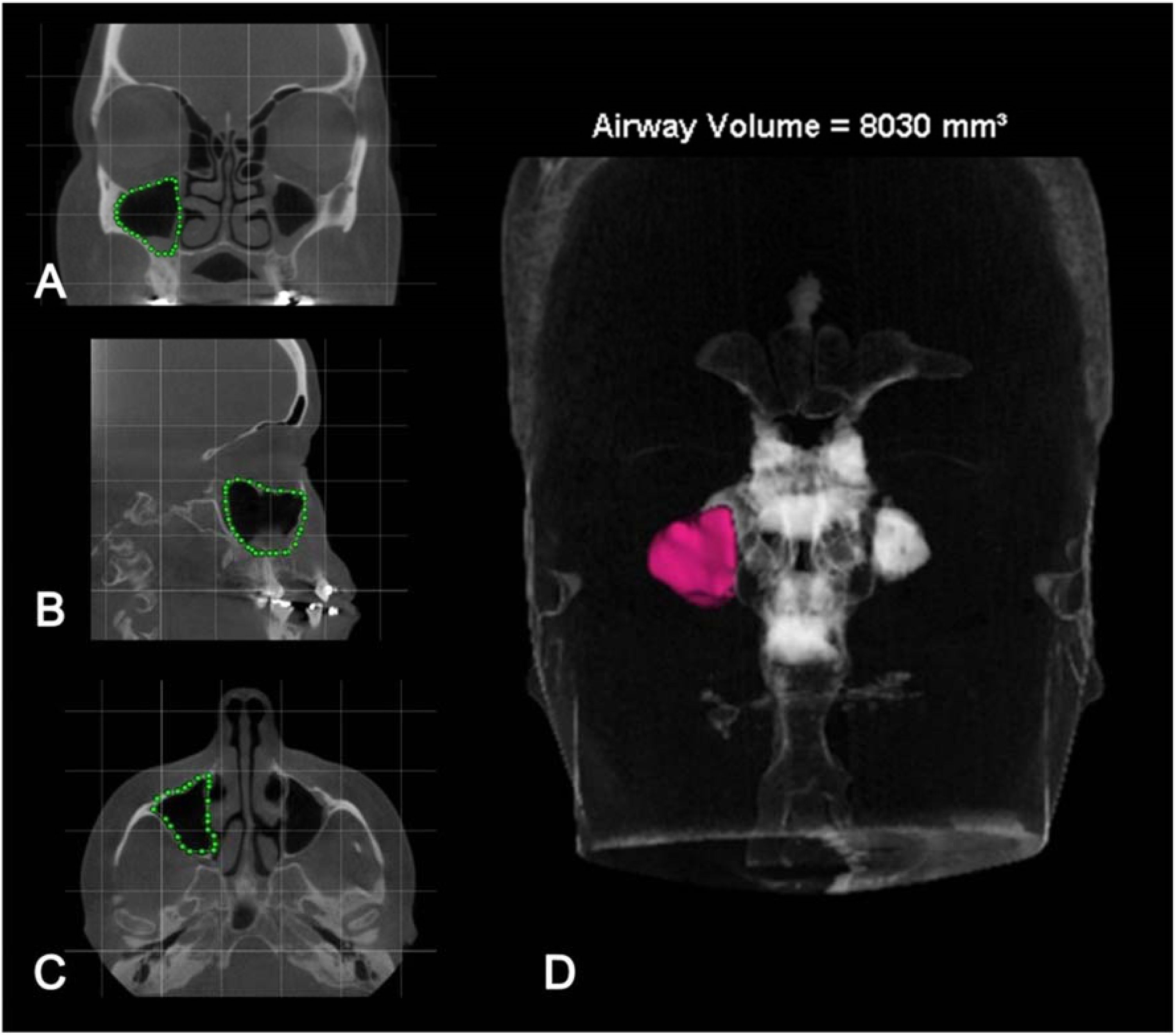fig0010