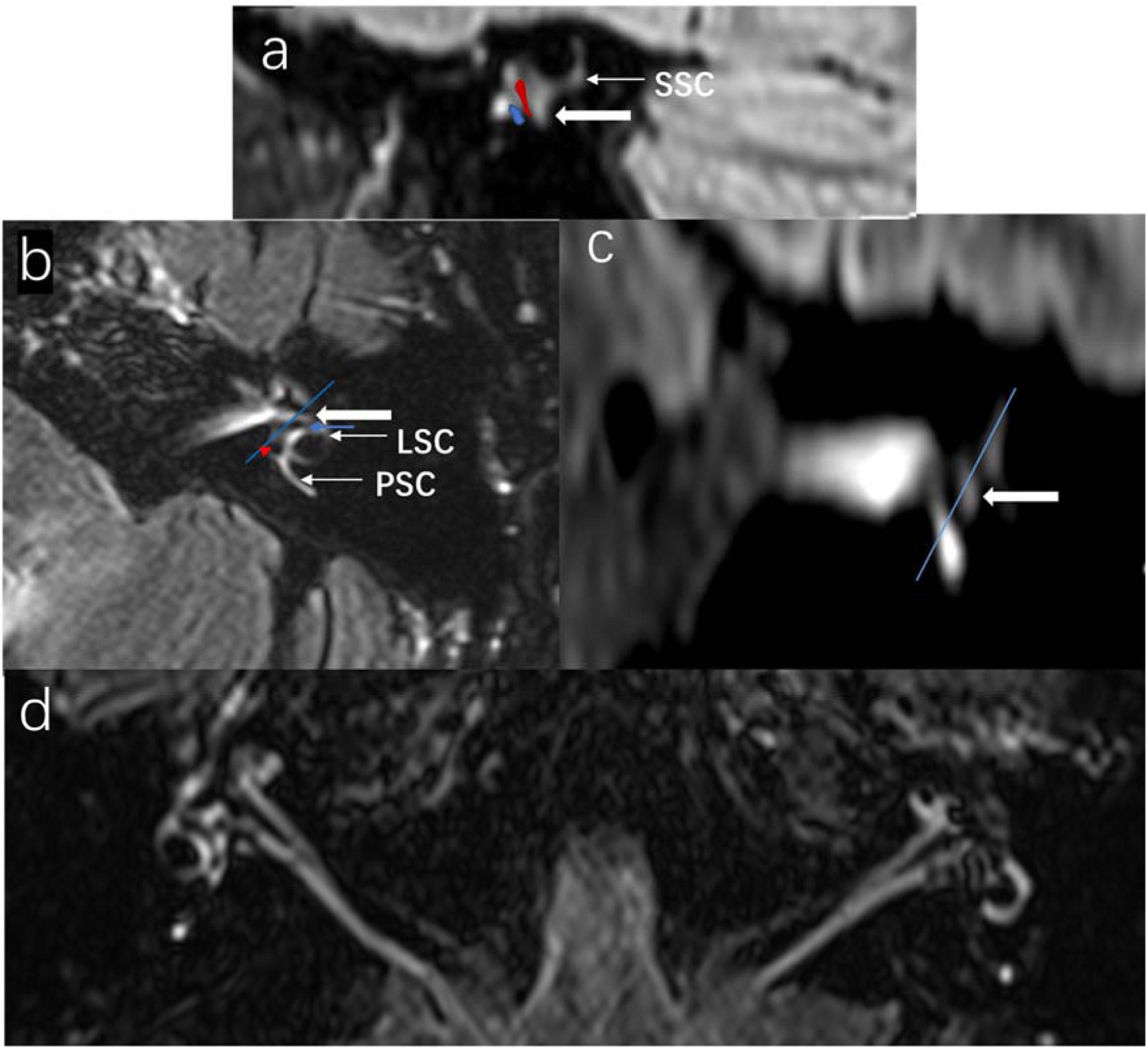 fig0010