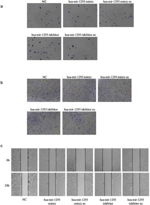 Hsa-miR-1293 regulates clone formation, invasion, and migration in TU212 cells. (a) Clone formation assay shows hsa-miR-1293 overexpression reduces cell colony formation (NC; Scale bar = 200 μm). (b) Transwell assay reveals hsa-miR-1293 inhibition increases cell invasion ability, while mimic transfection has no significant effect (NC; Scale bar = 500 μm). (c) Cell scratch assay demonstrates hsa-miR-1293 overexpression decreases cell migration ability (NC; Scale bar = 200 μm).
