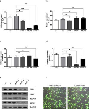 Silencing GLI1 regulates PTCH1 expression. (a) TU212 cells were transfected with siRNAs of different sequences, and the mRNA expression levels of GLI1, * p < 0.05, ** p < 0.01, *** p < 0.001. (b) GLUL, ns, not significant. (c) MAP1B, ns, not significant. (d) PTCH1 genes were detected by RT-qPCR. shGLI1-2 shows the highest silencing efficiency, significantly reducing GLI1 mRNA levels compared to control (con) and nc groups (* p < 0.05). (e) Western blot results confirm reduced GLI1 and PTCH1 protein levels. (f) Morphology of stably transfected cell lines TU212-shPTCH1 and TU212-PTCH1(Scale bar = 100 μm). PTCH1 promotes cell proliferation and regulates cell cycle progression in TU212 cells.