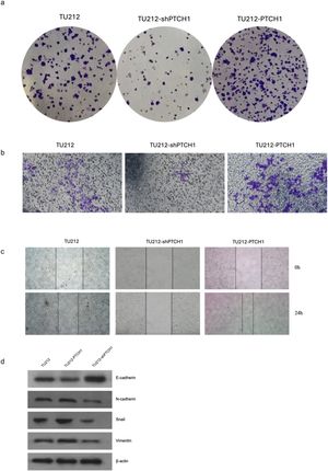 PTCH1 promotes clone formation, invasion, migration, and EMT in TU212 cells. (a) Clone formation assay shows PTCH1 overexpression increases colony formation, while PTCH1 silencing reduces it compared to controls (Scale bar = 200 μm). (b) Invasion assay reveals PTCH1 enhances cell invasion (Scale bar = 500 μm). (c) Cell scratch assay demonstrates PTCH1 overexpression promotes cell migration (Scale bar = 200 μm). (d) Western blot detection of EMT-related protein expression levels of TU212, TU212-shPTCH1 and TU212-PTCH1.