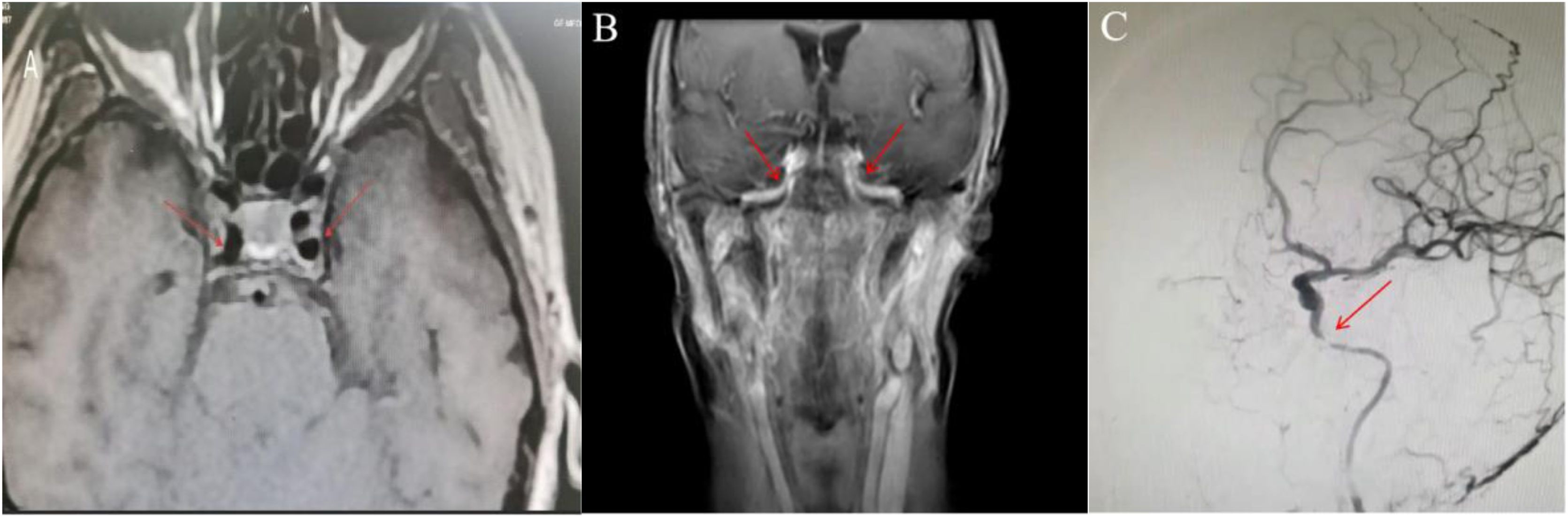 fig0015