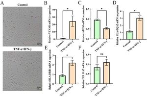 Endothelial cell responses to inflammatory stimuli in vitro. (A) HUVECs cultured in standard medium (Control) or supplemented with TNF-α and IFN-γ. Scale bar = 100 μm. (B‒F) RT-qPCR analysis of relative mRNA expression for (B) VCAM-1, (C) APOM, (D) HLA-DQA2, (E) HLA-DRB1, and (F) COL11A2. Data are presented as mean ± SD of three independent experiments (* p < 0.05).