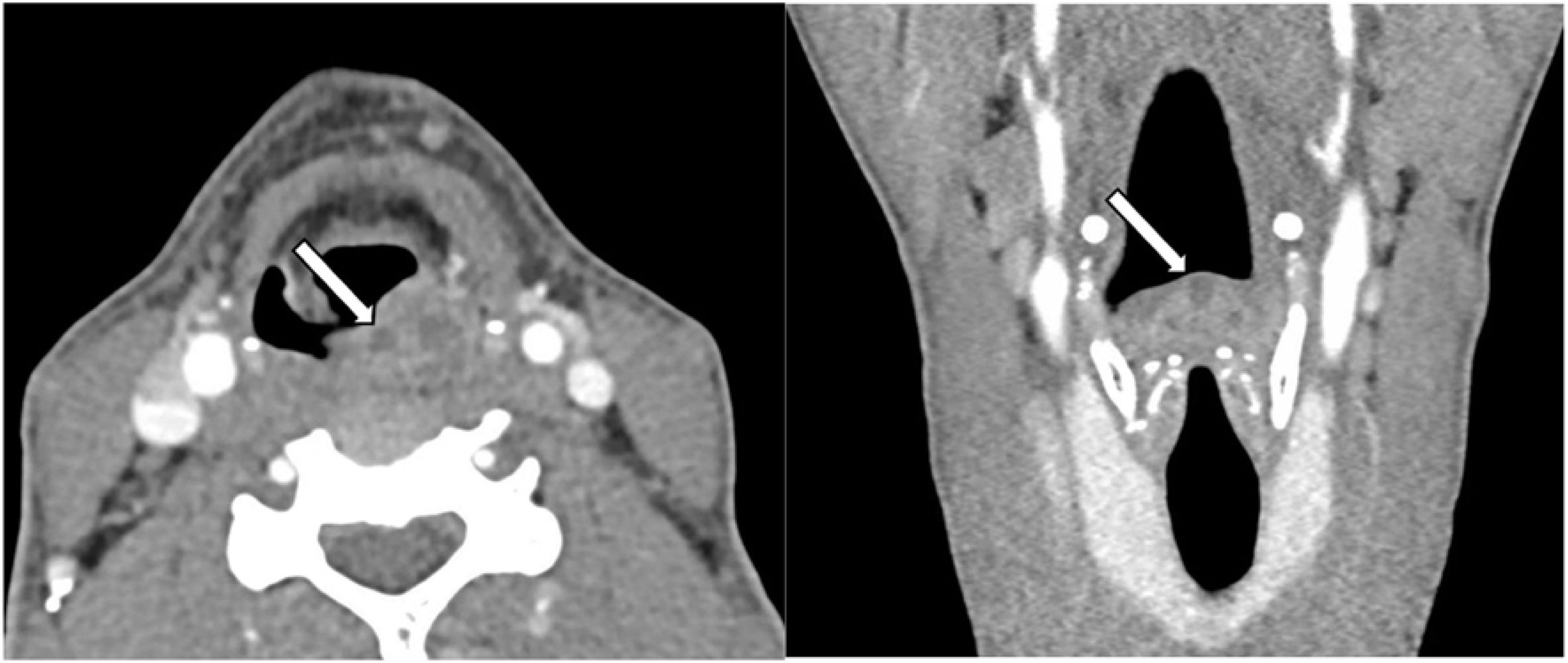 fig0005